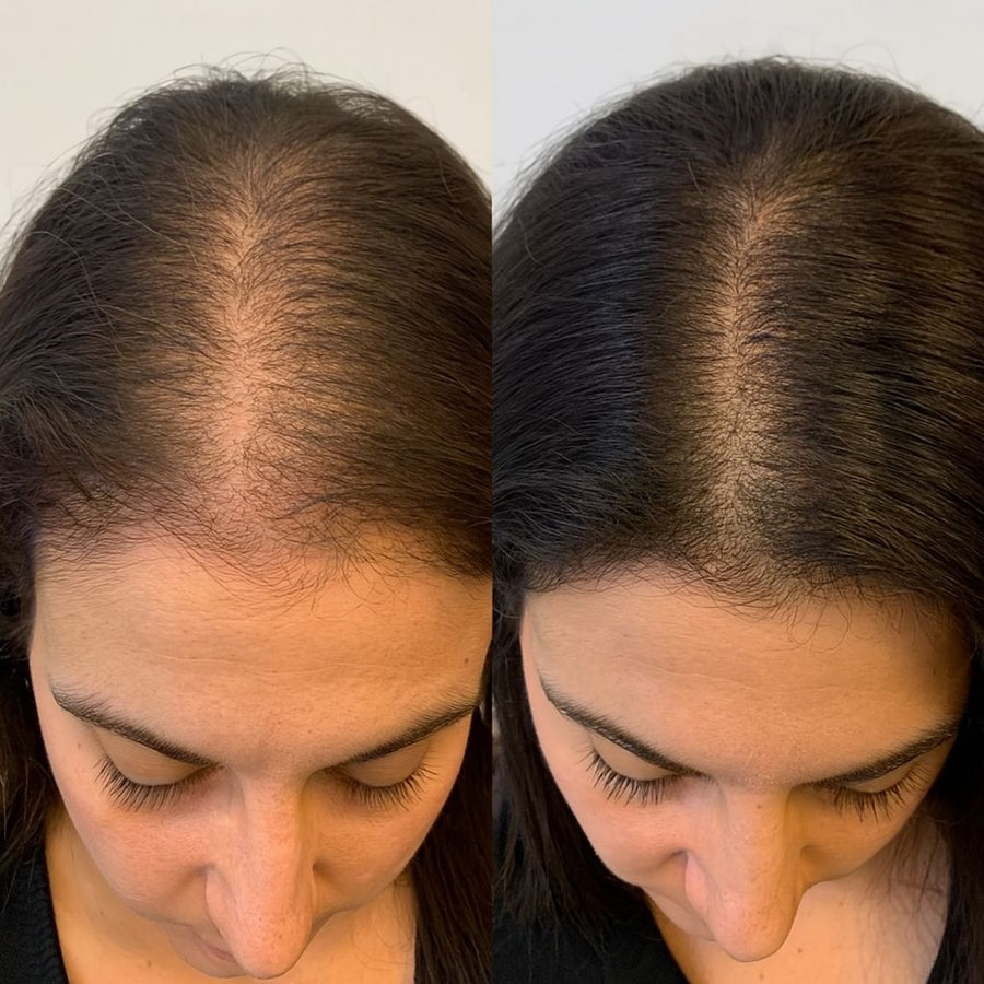 Before and after