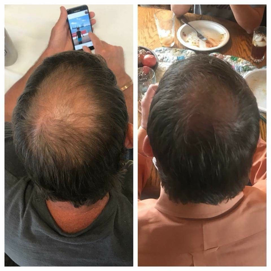 Before and after