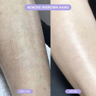Wholly Bare - Hair Removal Mousse