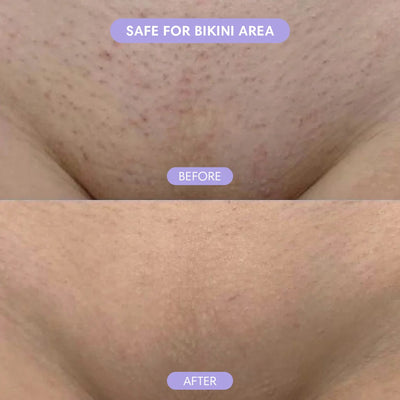 Wholly Bare - Hair Removal Mousse