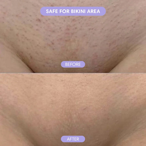 Wholly Bare - Hair Removal Mousse